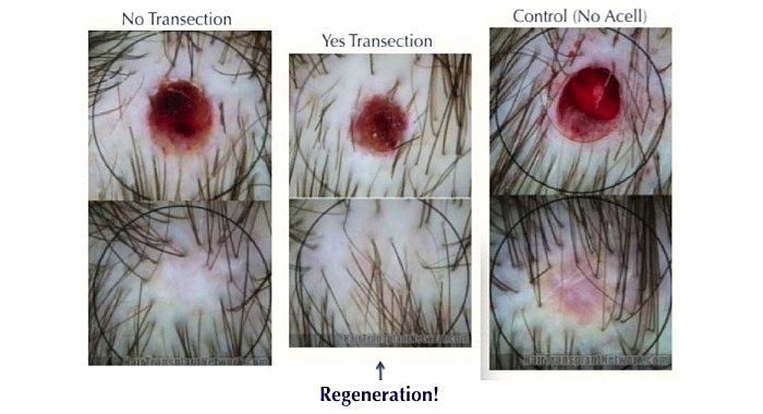hair loss forum piloscopy hair transplant hair transplant how it works