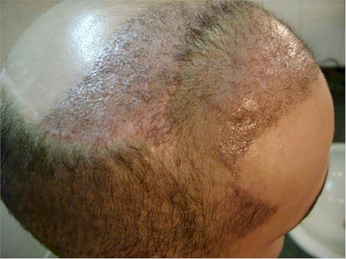 [image]