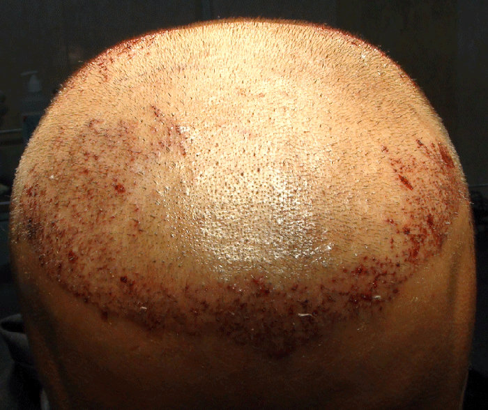 222_image1051.gif