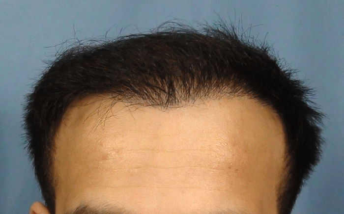 222_image916.gif