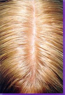 scalp.jpg (19291 bytes)