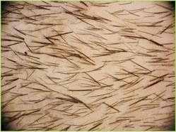 hair regrowth trial