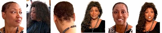 african hair replacement