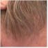 lace hair system