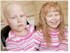 children hair loss