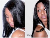 female hair loss